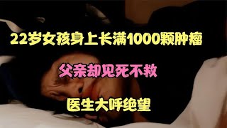 22岁女孩身上长满超1000颗肿瘤，父亲却见死不救，医生大呼绝望