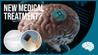 Brain Implants are Here: Blackrock's Neuroport & Synchron's Stentrode