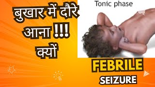 Kyo ata hai bacho me Bukhar ke Karan Daura ?? Febrile seizures | Causes | what to do ???