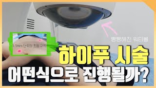 자궁근종 비수술 치료 하이푸 시술 과정 공개! 시술 전 시술 후 총정리 Non-surgical treatment Hifu