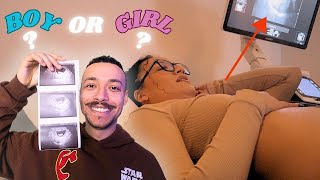 Our First Ultrasound | Gender Reveal??