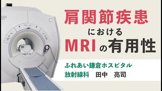 肩関節疾患におけるMRIの有用性