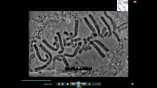 Real Microscopic Mitosis ( MRC )