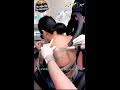 Wendy’s 🫶🏻 Heart ⚡️Laser Tattoo Tx #1 at Las Vegas Dermatology