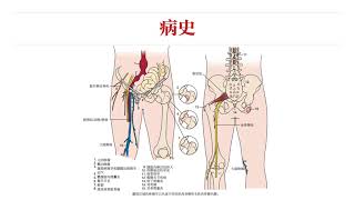 【骨科物理治疗评估】11髋关节｜解剖病史观察检查