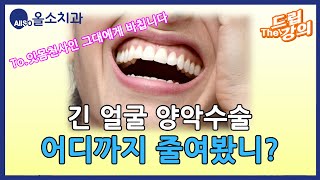 28. 긴얼굴 양악수술, 어디까지 줄여봤니?