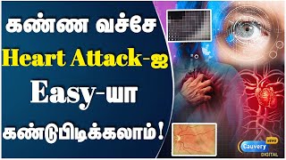 உங்க கண்ணுல இந்த பிரச்னை இருக்கா? அப்போ உடனே Check பண்ணுங்க.. | Myocardial Infarction | Coronary