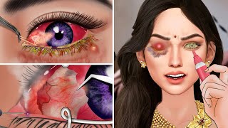ASMR The best treatment swollen corners of eyes, remove stye,red eyes and clean up leaky eyes