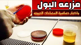 تحليل مزرعه البول وإختبار حساسية المضادات الحيويه - شرح Urine Culture and Sensitivity test