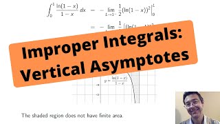 Improper Integration - Vertical Asymptotes