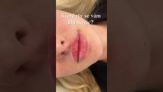 Jaké rty jsou největší? Soutěž zvětšení rtů #lipsfiller #zvetsenirtu