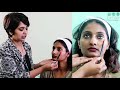 TREATMENT OF DARK CIRCLES UNDER EYES WITH FILLERS | DR RASYA DIXIT | SKIN CARE TIPS