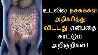 உடலில் நச்சுக்கள் அதிகரித்து விட்டது என்பதை காட்டும் அறிகுறிகள் | Nalamudan Vaazha