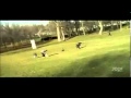 نسر يهاجم أحد الأطفال في حديقة كندية ويخطفه !! Eagle attacking a child in a Canadian park