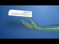 NHS Mid Yorkshire:  Treating Dupuytren's