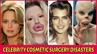 35 Celebrity Plastic Surgery Disasters – You’d Never Recognize Them Today!