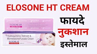 Elosone ht skin cream, kaise use kare, side effects, review, Hindi, Benefits, Dose, how to use, HCP