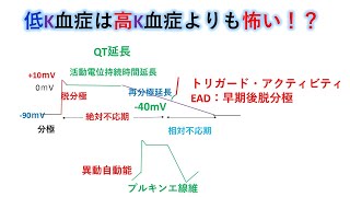 心電図：暗記からの卒業 第50話　低K血症