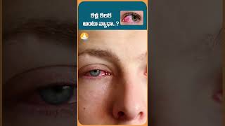 కళ్ల కలక అంటు వ్యాధా ? | #drcalmssanjeevani #drcalm #shorts #conjunctivitis #pinkeye #eyeinfection