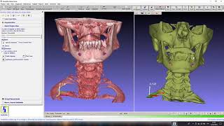 GuideMia demo of CT data segmentation