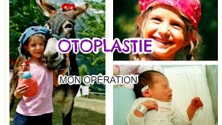 OTOPLASTIE • Mon opération, je vous dis tout