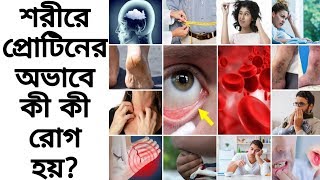 প্রোটিনের অভাবে কী রোগ হয়? এই ১২টি লক্ষণ দেখলে বুঝবেন শরীরে প্রোটিনের ঘাটতি আছে! Protein Deficiency