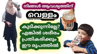 #SymptomsOfDehydration/ആവശ്യത്തിന് വെള്ളം കുടിക്കാത്തവർ ആണെങ്കിൽ ശരീരം പ്രതികരിക്കും ഈ രൂപത്തിൽ|