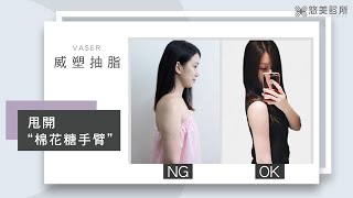 Vaser 威塑超音波抽脂新概念 • 客製雕塑明星級線條！