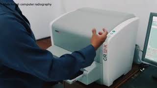 Cara Penggunaan Aplikasi CR (Computed Radiography)