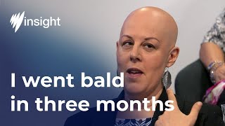 Living with Alopecia Areata | SBS Insight