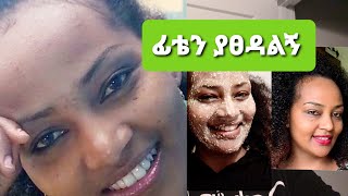 የተለያዩ ፊታችን ላይ የሚወጡ ምልክቶች ማጥፊያ ውህድ  - Home Made Treatment for Sensitive Skin