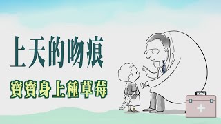 【上天的吻痕寶寶身上種草莓】【大愛醫生館精選】