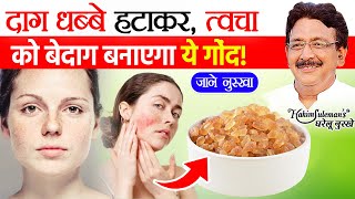 त्वचा की समस्या से अब ना हो परेशान, जानें नुस्खा Home Remedies for skin care