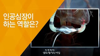 맞춤형 줄기세포, 체세포 복제 배아줄기세포 - (20150107_530회 방송)_신년기획 ‘미래의학’ 제1부 줄기세포, 어디까지 와 있나