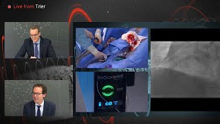 Shockwave IVL Coronary Real-World Cases, Outcomes \u0026 Algorithms: An InCathLab Webinar