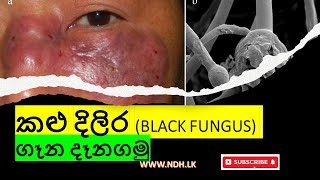 කලු දිලීර (Black Fungus) ගැන දැනගමු