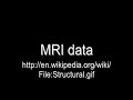 mri visualization demo using cuda