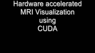 MRI visualization demo using CUDA