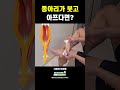 종아리 붓기 통증해결 shorts