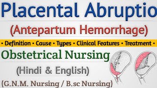 Placental Abruptio In Hindi // Abruptio Placenta क्या होता है // Antepartum Hemorrhage Lecture