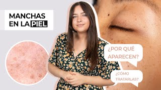 CAUSAS DE LAS MANCHAS EN LA PIEL O HIPERPIGMENTACIÓN | ARGANOUR