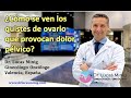 🔔 ¿Cómo se ven los quistes de ovario que provocan dolor pélvico? Dr.Lucas Minig. Ginecólogo Oncólogo