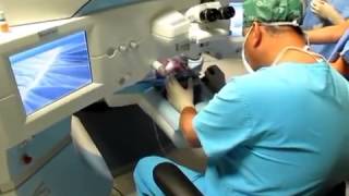 LASIK in 11-years old girl with femtosecond laser VisuMax in NeoVize Eye Clinic