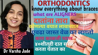 #BRACES Complete information for India|वेडेवाकडे दात सरळ करणे| दातांना क्लिप (ब्रेसेस) लावणे