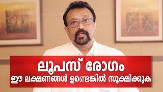 എന്താണ് ലൂപസ് രോഗം | SLE or Lupus Disease Malayalam Health Tips