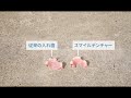 スマイルデンチャー（smiledenture