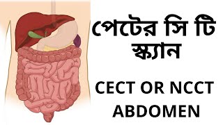 পেটের সি টি স্ক্যান ,পেটের টেস্ট  .CT SCAN OF ABDOMEN AND PELVICE