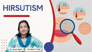 Hirsutism |Endocrinology Lecture Series | DNB theory Class | DNB OBGYN coaching All India chapter...