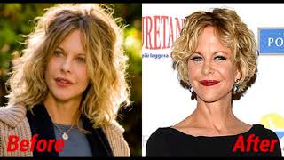 Meg Ryan's Plastic Surgery: too noticeable?