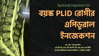 Epidural Injection 03 | বয়স্ক PLID রোগীর এপিডুরাল ইনজেকশন | Doctor Shah Alam